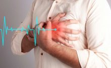 Infarto